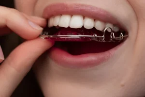 بهترین متخصص ارتودنسی متحرک در تهران