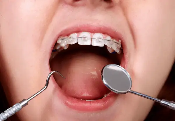 منظور از ارتودنسی ثابت چیست