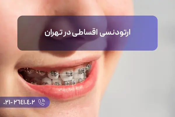 ارتودنسی اقساطی تهران