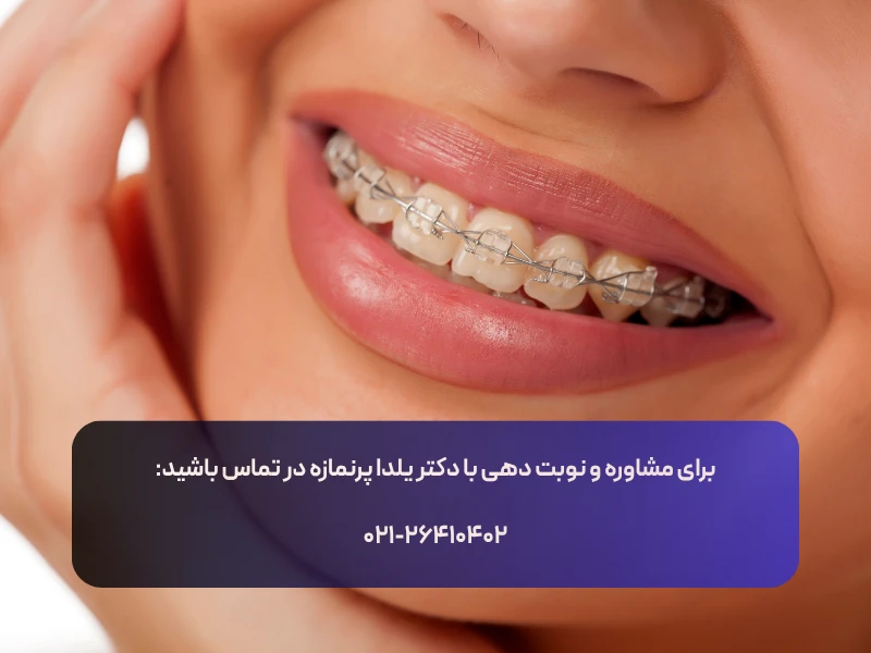 متخصص ارتودنسی تهران